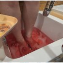 힐링약손 이미지