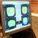 밝은세상콘택트 이미지