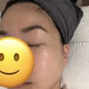 A37 | 청라 피부관리 르페에스테틱에서 예민, 홍조 관리 받은 후기