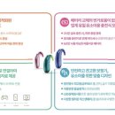 일등 보청기 이미지