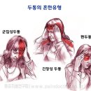 두 통 (Headache) 이미지