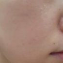(주)링크헬스케어 | 리터니티 율무팩 솔직후기! 요철케어 피지 정리 모공팩 올영세일추천템