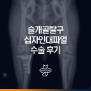 평택 강아지 슬개골탈구 십자인대파열 TPLO 수술 후기 [수술잘하는동물병원]