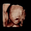 천안제일의원 이미지