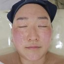 빛나피부 | 삼송피부관리 빛나뷰티 단백질 관리로 수분 채운 에스테틱 만족 후기