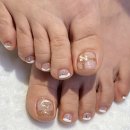 역삼-1270 | 네오네일 하이푸스 역삼점에서 내성발톱 해결한 후기, 감동의 눈물...