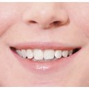 이모든치과의원 | 투명교정 치료 후기 불편하지않는 치아교정방법