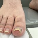 온니네일 - 강남구 테헤란로 322 | 대전 유성 탑립동 내성발톱 제대로 관리하고 싶다면 온니네일&BHP 관평점