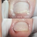 네일조아 이미지