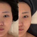 엠아이헤어 | 신길동 피부관리 "미엠아이에스테틱" / 신풍역 피부관리, 영등포구 피부관리, 신길피부관리, 영등포...