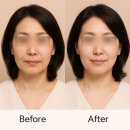 미소라인성형외과의원 이미지