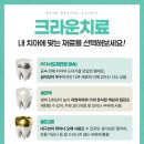 크라운치과기공소 이미지