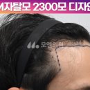 헤어라인 이미지
