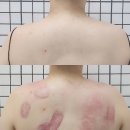 신정역 에스테틱 승모근 관리 '다나음바디케어 신정점' 솔직후기