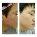나르시피아 | 아산 피부샵 나르시피아 아산지사 방문 후기