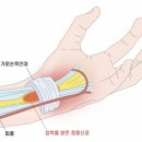 공정형외과의원 | 강남손목터널증후군 치료 후기? 너무 믿지 마세요 - 대표원장 작성