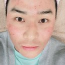 담양이비인후과의원 | 전라남도 목포시 피부과 전문 병원 추천 TOP 6곳