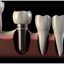 현대웰치과의원 이미지