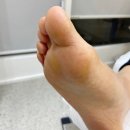 레푸스 연산점 네이버블로그