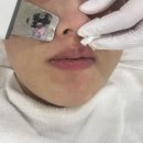 일므이 에스테틱 | 잠실피부관리 추천 잠실 여드름 피지 블랙헤드 케어 일므이 에스테틱 방문 후기