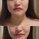 한정아 에스테틱 이미지