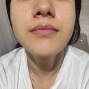 화이트피부관리실 | [리프온스킨] 천연팩으로 관리하는 신규오픈 미사 피부관리실 후기