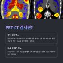 pet40고0124 | PET-CT 검사 과정부터 후기·주의사항까지 완벽 가이드