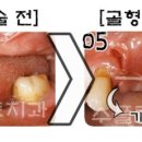 수플란트 이미지