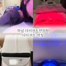 하남 다이어트한의원 다이어트약침 통증 시간 후기