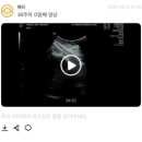 닥터황치과의원 | 대전 산부인과 : 서브 산부인과, 초음파 화질 좋은 “닥터황여성의원” 후기