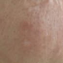 본메딕스 이미지