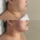 더 흐름 | 율량동 피부관리 찾는다면,상담과 관리 흐름이 인상적이었던 더리파인 후기