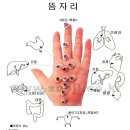 수지침 이미지