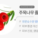 에스엔안 이미지