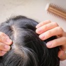 [단독] 한 알 2만5000원 탈모약 싸지나... 원형탈모 보험 적용 추진한다 이미지