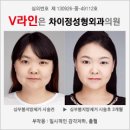 [웰페어뉴스] “죄 없는 사람이 짐승 보다 못한 삶을 살았던 역사” 형제복지원 피해 생존자 기획 인터뷰③-김종팔 씨 이미지