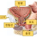 전립선염, 전립선비대증. 이미지