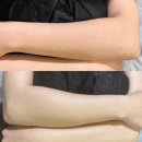 아카시아 약국 | 팔에 윤기 좌르르~ 수원 여자 왁싱 다녀온 진짜 후기