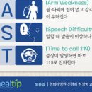 뇌졸중 초기 골든타임, 방법과 전조 확인 이미지