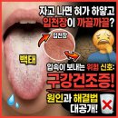 고려이비인후과의원 | 자고 나면 혀가 하얗고 입천장이 까끌까끌, 입속 건조함 해결법은? 광주베스트이비인후과