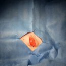 소로동물병원 | 강아지 가슴 혹 지방종 수술 후기: CT로 다발성 지방종 확인 후 안전한 절제와 회복까지