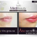 수유반영구화장:입술문신으로 얼굴생기찾기 이미지
