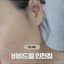 씨유 서영더엘점 | 검단 피부 기미 색소 비비드엘 후기 인천 아라역 잡티 관리 김포에서도 가까워요