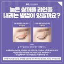 비아이오