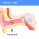 귀간지러움 이유 외이도염 치료 이미지