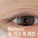 릿뷰티 네이버블로그
