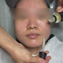 홍성 에스테틱 추천 – 홍성 엘라인 이지다 이지샷 케어(버터케어) 후기