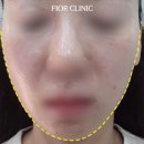 피오르의원 네이버블로그