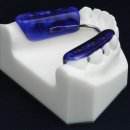 스타치과기공소 이미지