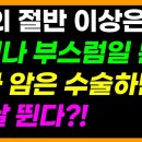 암의 절반 이상은 종기나 부스럼일 뿐 진짜 암은 수술하면 더 날뛴다. 이미지